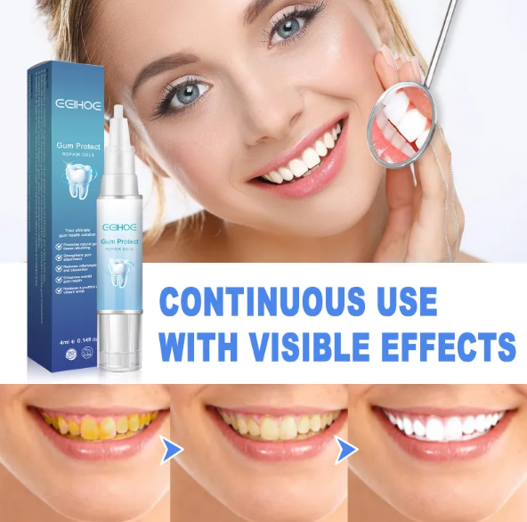 Teeth Repair Gel Wear for Art Thou