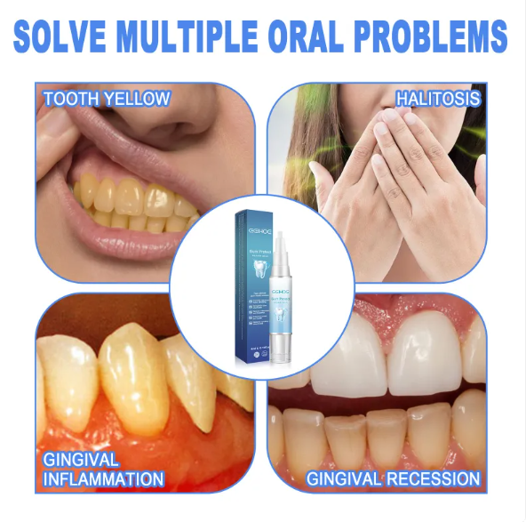 Teeth Repair Gel Wear for Art Thou