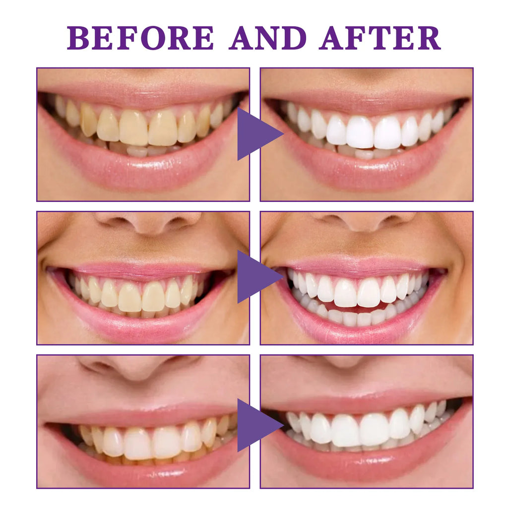 V34 Tooth Cleaning Mousse Wear for Art Thou