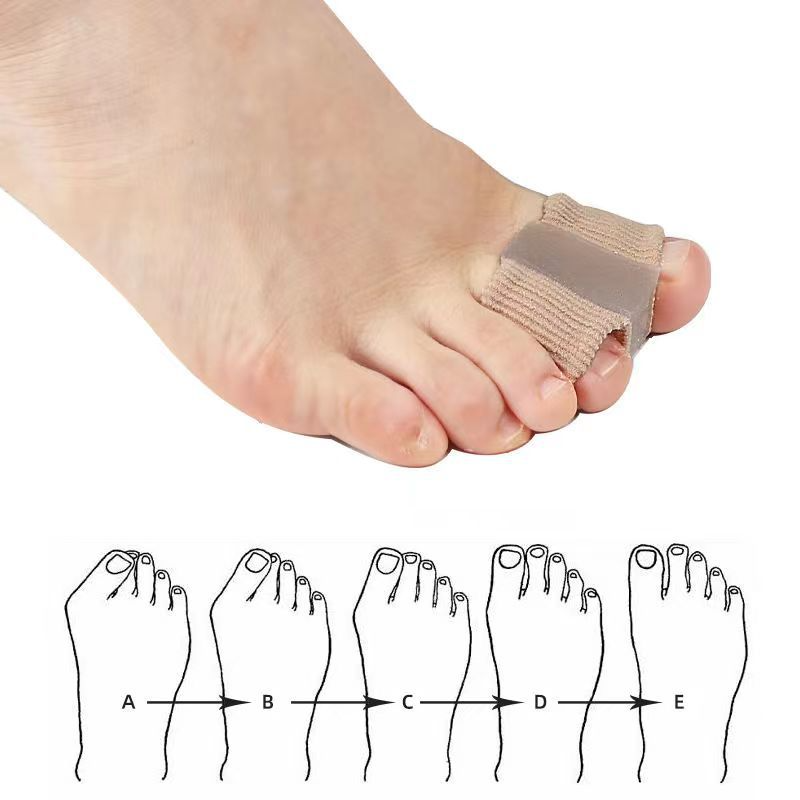 Fiber Toe Separator Wear for Art Thou