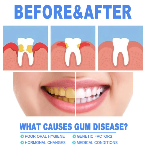 Teeth Repair Gel Wear for Art Thou