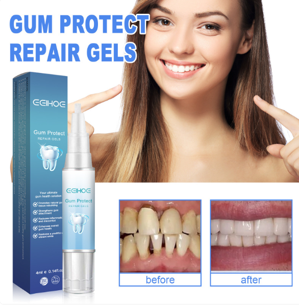Teeth Repair Gel Wear for Art Thou